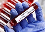 В Салде продолжают регистрировать новые случаи заражения коронавирусом