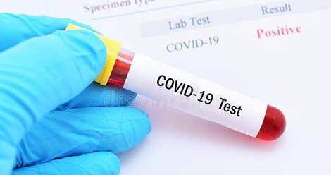 На ВСМПО прокомментировали информацию о массовом тестировании заводчан на COVID&#8209;19